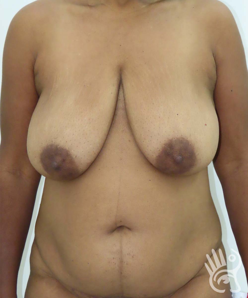 mom-front-before